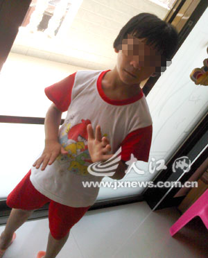 南丰一儿童患双性畸形想变女儿身