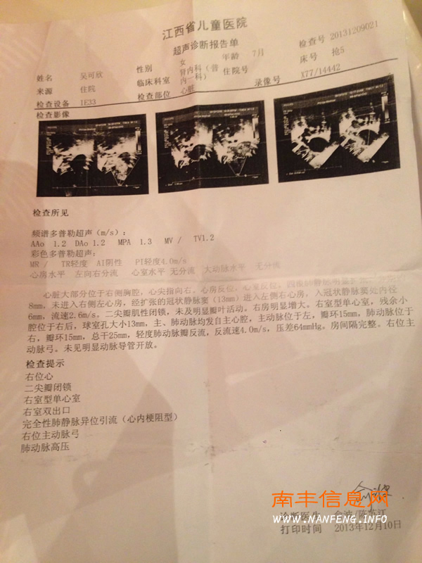 【爱心救助】南丰两岁女童吴可欣患罕见心脏疾病急需帮助